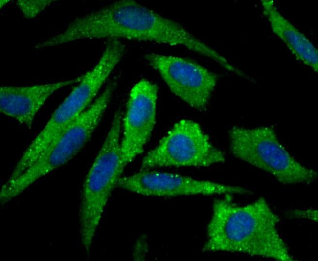 Aromatase Antibody in Immunocytochemistry (ICC/IF)