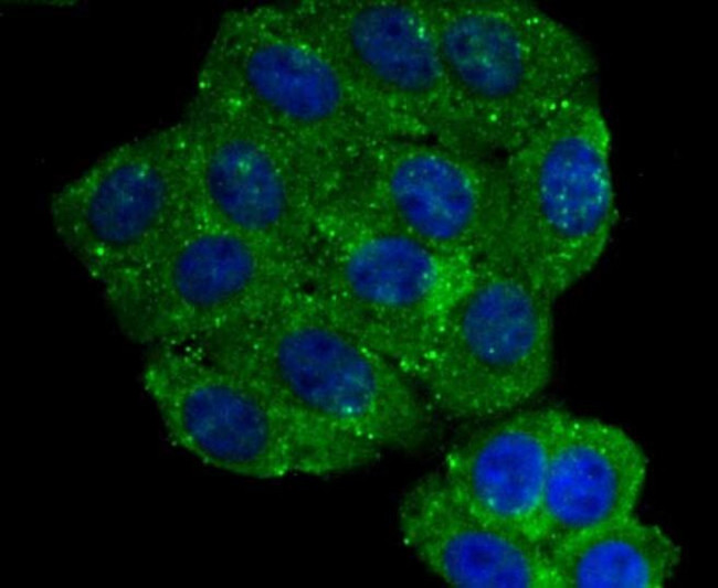 Aromatase Antibody in Immunocytochemistry (ICC/IF)