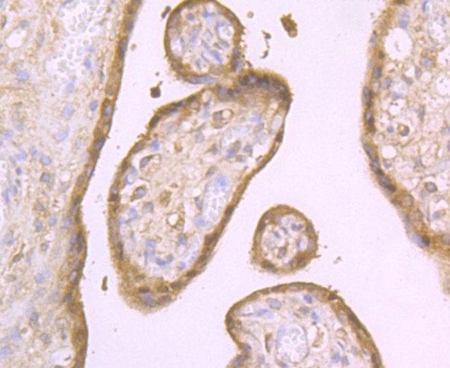 Aromatase Antibody in Immunohistochemistry (Paraffin) (IHC (P))