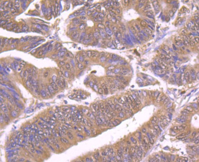 HIP1 Antibody in Immunohistochemistry (Paraffin) (IHC (P))