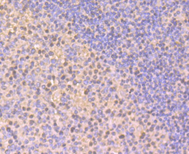 RAB7A Antibody in Immunohistochemistry (Paraffin) (IHC (P))