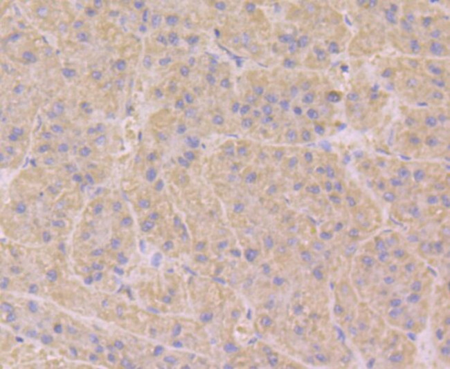 RAB7A Antibody in Immunohistochemistry (Paraffin) (IHC (P))