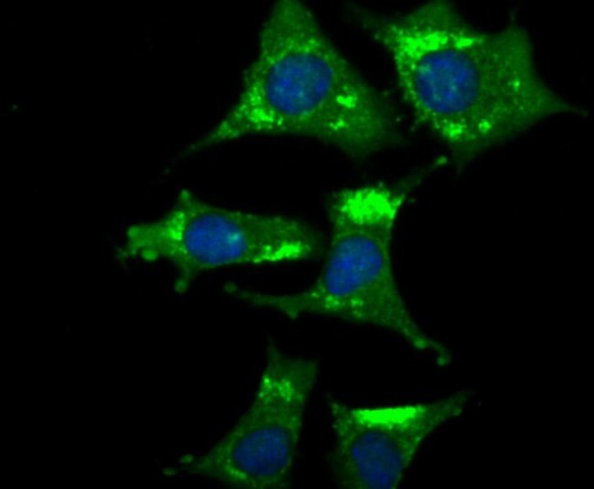 NGF Antibody in Immunocytochemistry (ICC/IF)