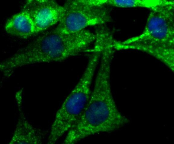 NGF Antibody in Immunocytochemistry (ICC/IF)