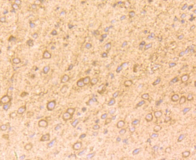 NGF Antibody in Immunohistochemistry (Paraffin) (IHC (P))