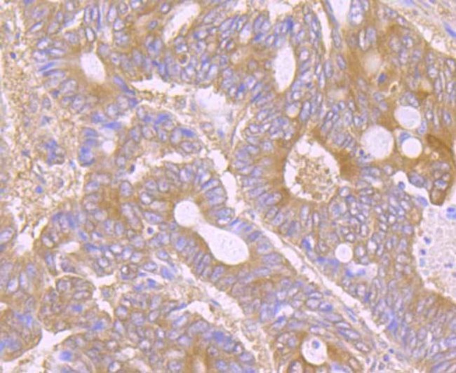 CD266 (TWEAK Receptor) Antibody in Immunohistochemistry (Paraffin) (IHC (P))