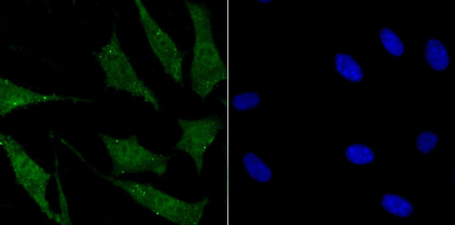 SUFU Antibody in Immunocytochemistry (ICC/IF)