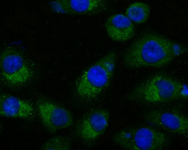 SUFU Antibody in Immunocytochemistry (ICC/IF)