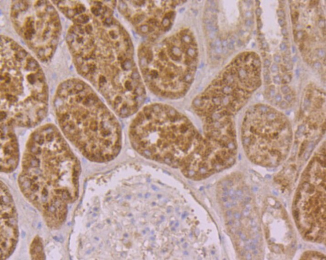 SUFU Antibody in Immunohistochemistry (Paraffin) (IHC (P))