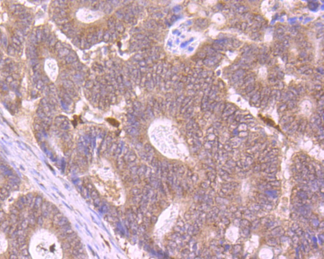 SUFU Antibody in Immunohistochemistry (Paraffin) (IHC (P))