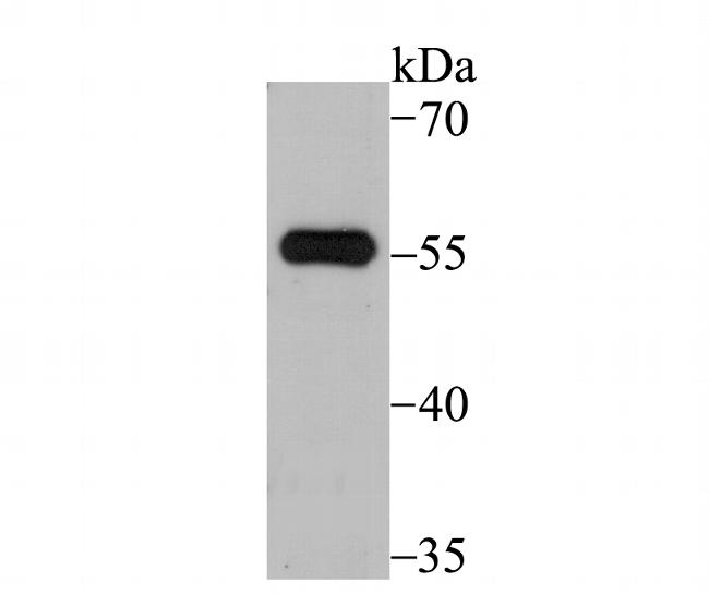 SUFU Antibody in Western Blot (WB)