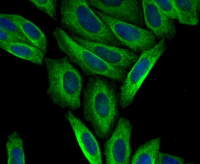 CTGF Antibody in Immunocytochemistry (ICC/IF)