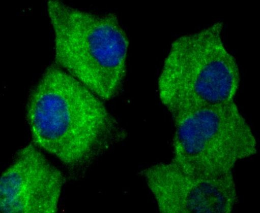 CTGF Antibody in Immunocytochemistry (ICC/IF)