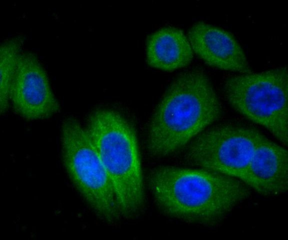 CTGF Antibody in Immunocytochemistry (ICC/IF)