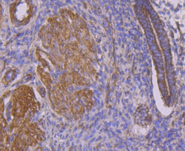 CTGF Antibody in Immunohistochemistry (Paraffin) (IHC (P))