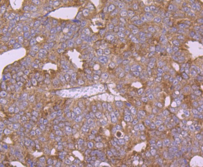 CTGF Antibody in Immunohistochemistry (Paraffin) (IHC (P))