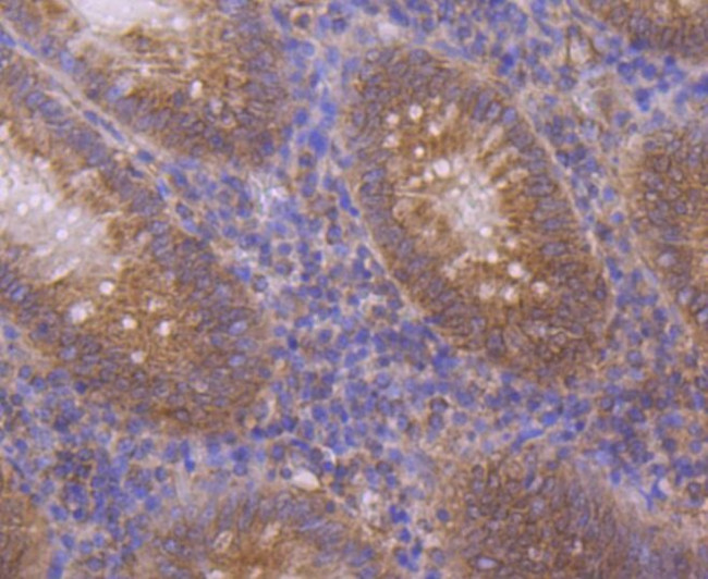 CTGF Antibody in Immunohistochemistry (Paraffin) (IHC (P))