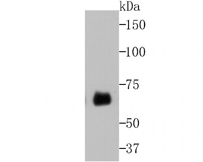 Butyrylcholinesterase Antibody in Western Blot (WB)