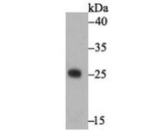 Staphylococcus Enterotoxin A Antibody in Western Blot (WB)