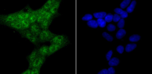 ROC1 Antibody in Immunocytochemistry (ICC/IF)