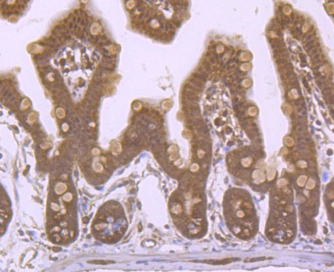 ROC1 Antibody in Immunohistochemistry (Paraffin) (IHC (P))