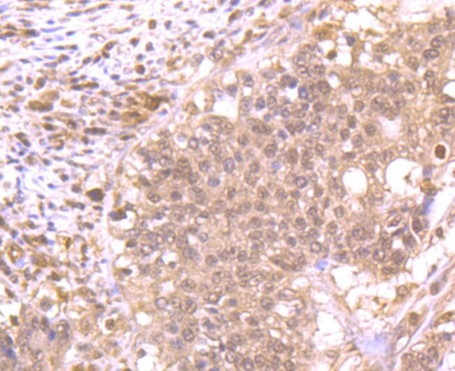 ROC1 Antibody in Immunohistochemistry (Paraffin) (IHC (P))