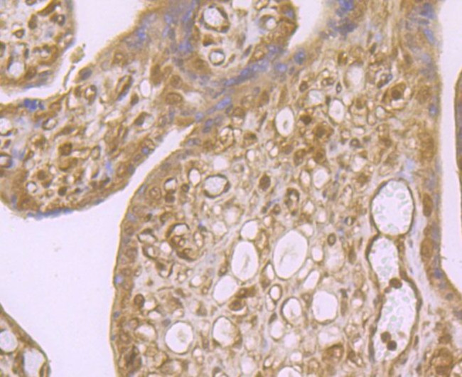 ROC1 Antibody in Immunohistochemistry (Paraffin) (IHC (P))