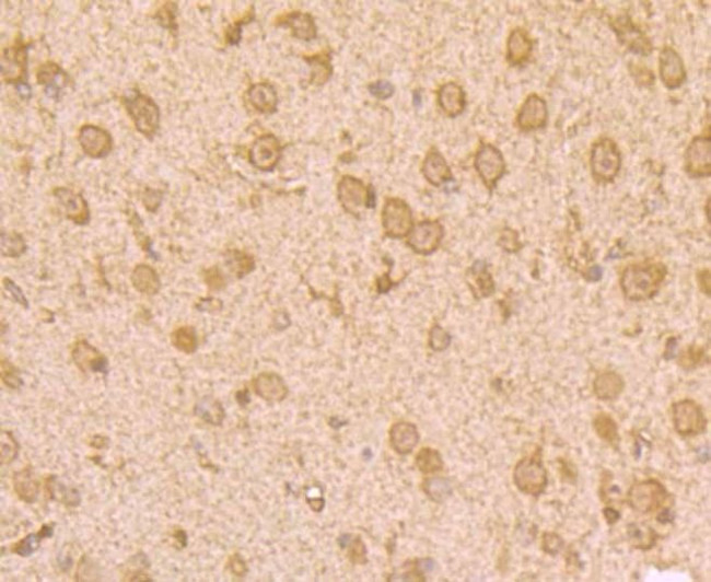 UAP1 Antibody in Immunohistochemistry (Paraffin) (IHC (P))