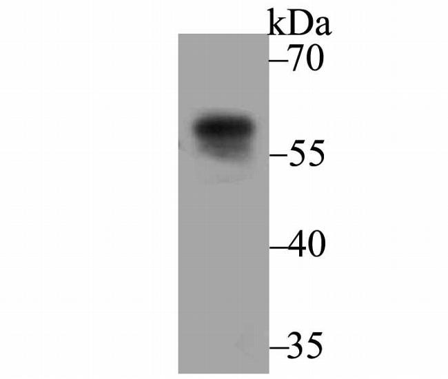 UAP1 Antibody in Western Blot (WB)