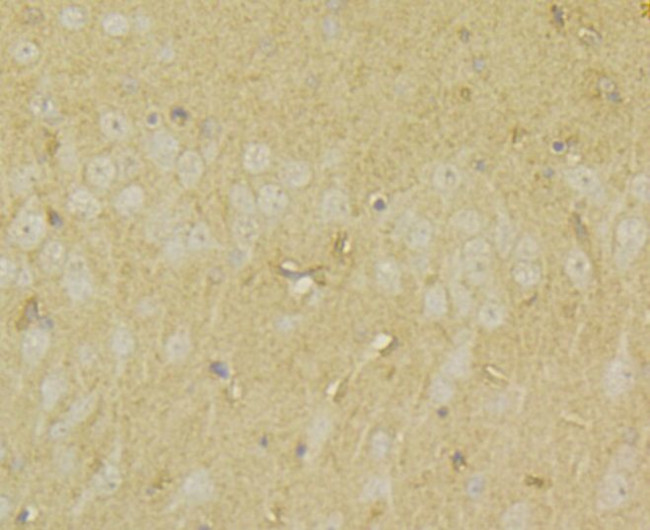 UAP1 Antibody in Immunohistochemistry (Paraffin) (IHC (P))