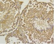 UAP1 Antibody in Immunohistochemistry (Paraffin) (IHC (P))