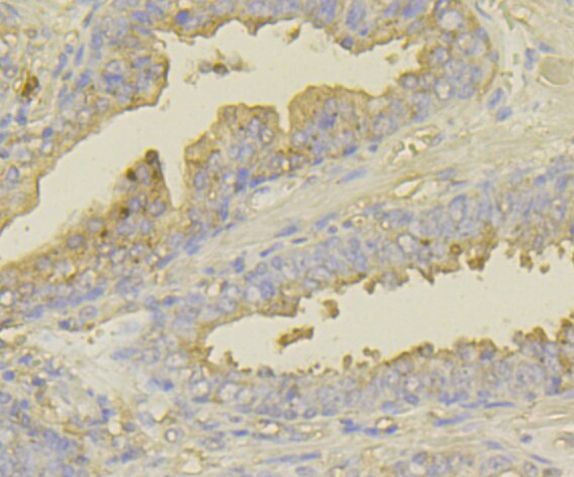 UAP1 Antibody in Immunohistochemistry (Paraffin) (IHC (P))