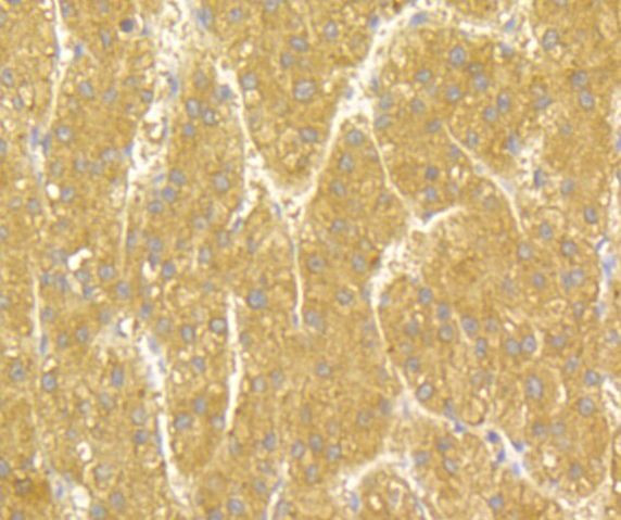 UAP1 Antibody in Immunohistochemistry (Paraffin) (IHC (P))