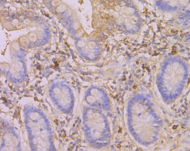 SERPINC1 Antibody in Immunohistochemistry (Paraffin) (IHC (P))