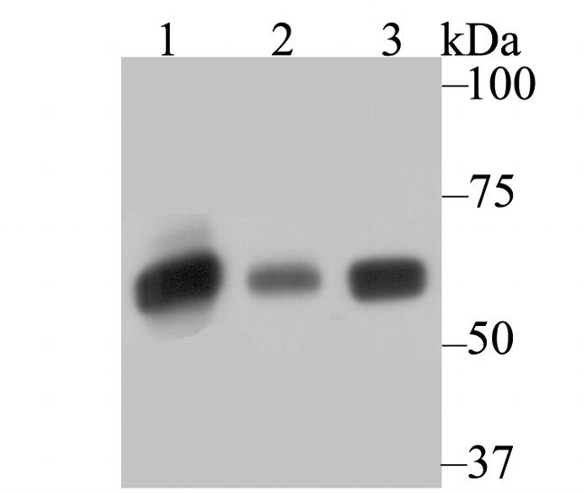 SERPINC1 Antibody in Western Blot (WB)