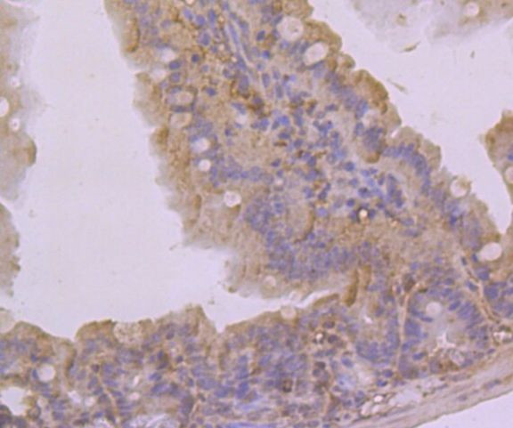 KCNK4 Antibody in Immunohistochemistry (Paraffin) (IHC (P))