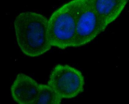 ORAI1 Antibody in Immunocytochemistry (ICC/IF)