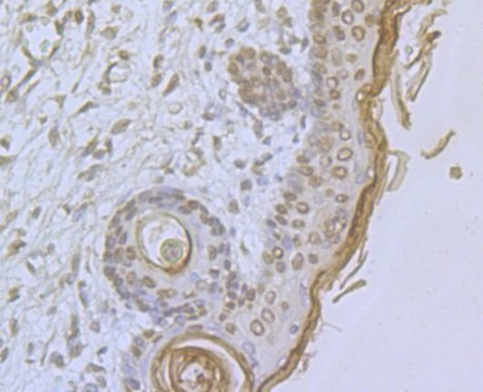 ORAI1 Antibody in Immunohistochemistry (Paraffin) (IHC (P))