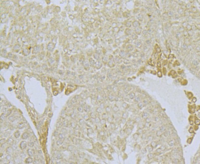 NDUFS3 Antibody in Immunohistochemistry (Paraffin) (IHC (P))