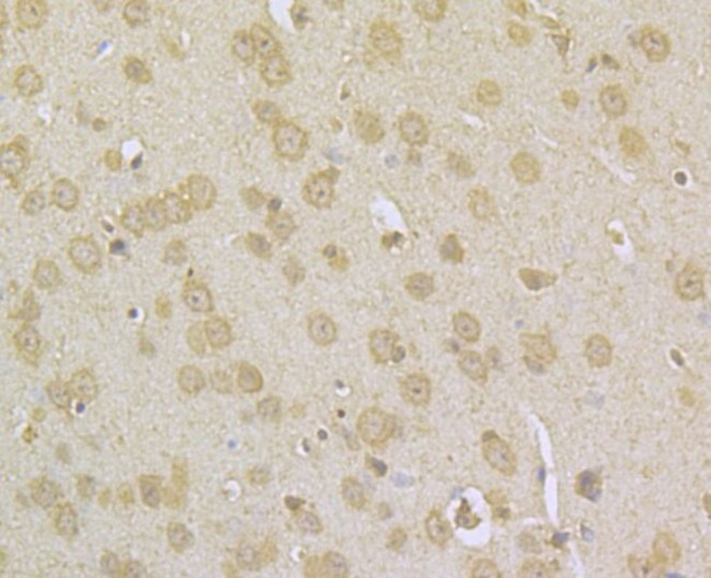 NDUFS3 Antibody in Immunohistochemistry (Paraffin) (IHC (P))