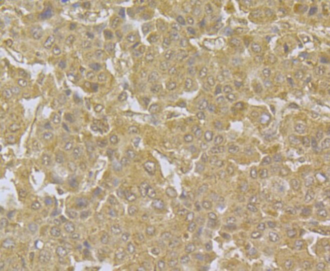 NDUFS3 Antibody in Immunohistochemistry (Paraffin) (IHC (P))