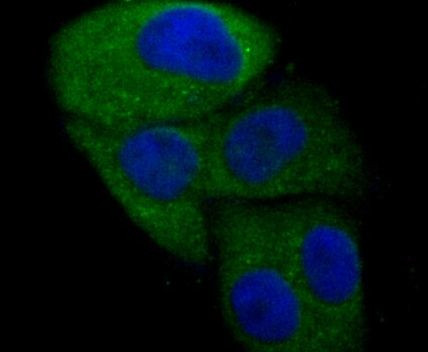 N-WASP Antibody in Immunocytochemistry (ICC/IF)