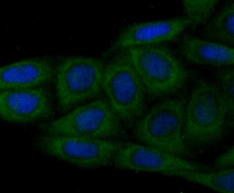 N-WASP Antibody in Immunocytochemistry (ICC/IF)