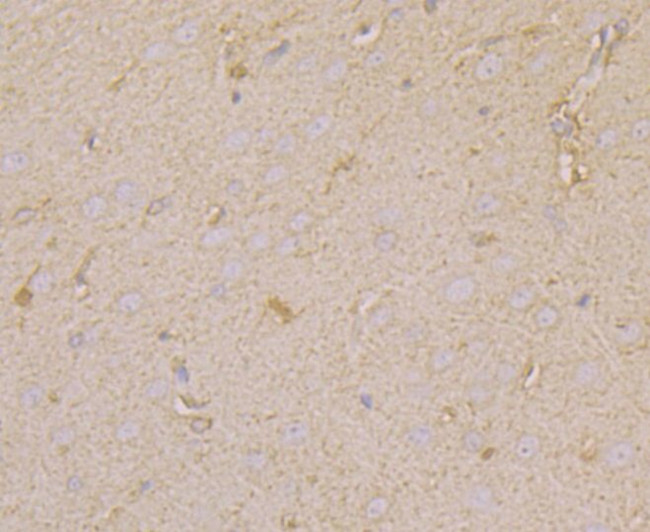 N-WASP Antibody in Immunohistochemistry (Paraffin) (IHC (P))