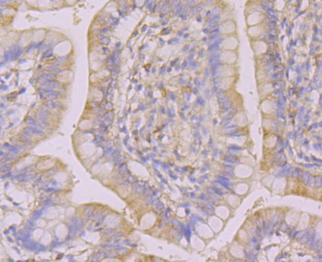 N-WASP Antibody in Immunohistochemistry (Paraffin) (IHC (P))