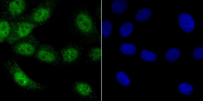 VDR Antibody in Immunocytochemistry (ICC/IF)