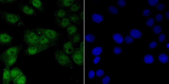 VDR Antibody in Immunocytochemistry (ICC/IF)