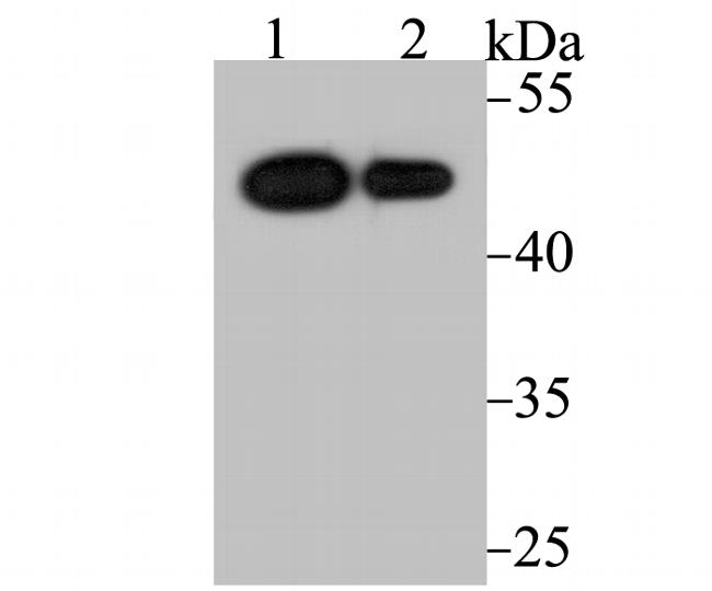 VDR Antibody in Western Blot (WB)