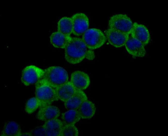 Ryanodine Receptor Antibody in Immunocytochemistry (ICC/IF)