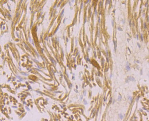 Ryanodine Receptor Antibody in Immunohistochemistry (Paraffin) (IHC (P))